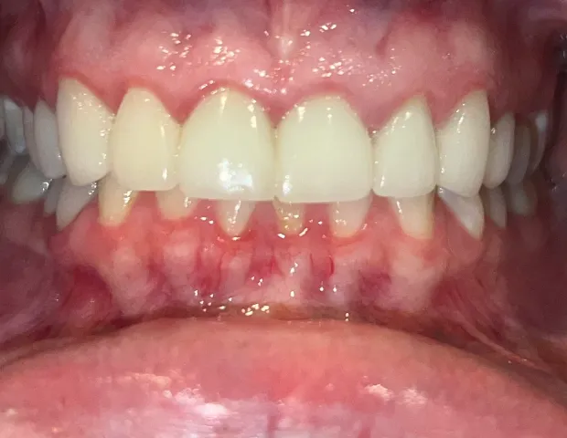 After image of dental treatment