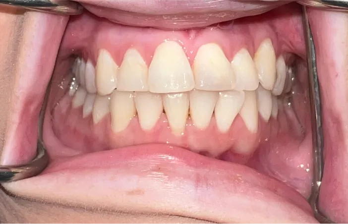 Before image of dental treatment