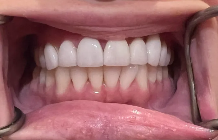 After image of dental treatment