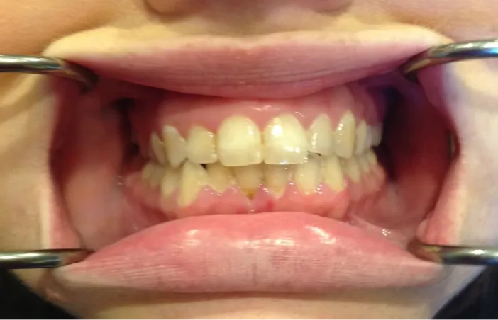 Before image of dental treatment