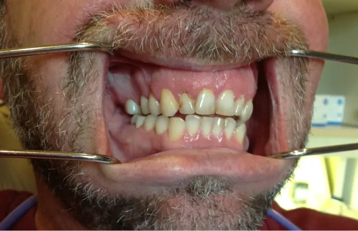 Before image of dental treatment