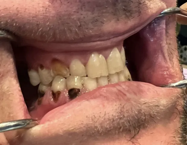 Before image of dental treatment